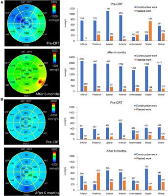 Clinical significance of regional constructive and wasted work in patients receiving cardiac resynchronization therapy